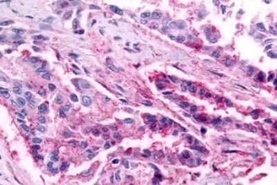 Immunohistochemistry-Paraffin: CCR1 Antibody - BSA Free [NLS1242]