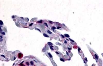 Immunohistochemistry-Paraffin: CCR1 Antibody - BSA Free [NLS1242]