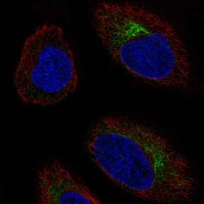 Immunocytochemistry/ Immunofluorescence: CCR10/GPR2 Antibody [NBP2-56544]