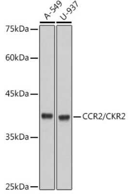 Western Blot: CCR2 Antibody (10L1L6) [NBP3-16117]