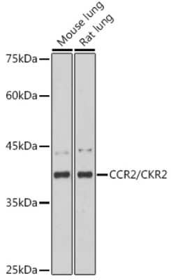 Western Blot: CCR2 Antibody (10L1L6) [NBP3-16117]