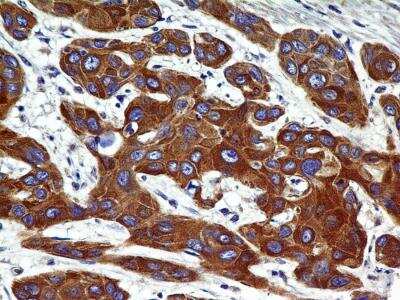 Immunohistochemistry-Paraffin: CCR2 Antibody (2D8) - BSA Free [NBP2-35333]