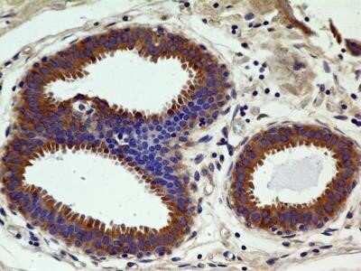 Immunohistochemistry: CCR2 Antibody (3G7) - Azide and BSA Free [NBP2-80623]