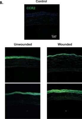 Immunohistochemistry: CCR2 Antibody - BSA Free [NBP1-48338]