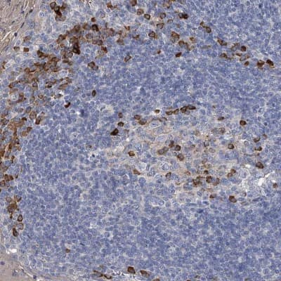 Immunohistochemistry-Paraffin: CCR4 Antibody [NBP1-86584]