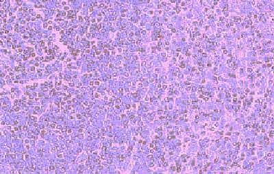 Immunohistochemistry-Paraffin: CCR5 Antibody [NB100-714]
