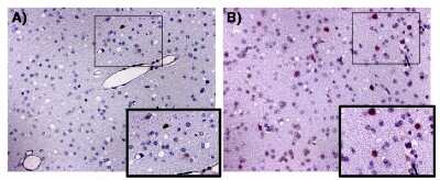 Immunohistochemistry-Paraffin: CCR5 Antibody [NBP2-31374]
