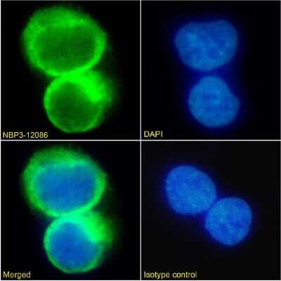 Immunocytochemistry/ Immunofluorescence: CCR5 Antibody (T21/8) - Chimeric - Azide and BSA Free [NBP3-12086]