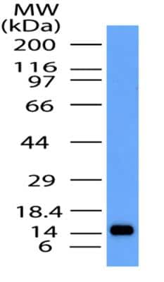 Western Blot: CCR5 Antibody [NBP2-31374]