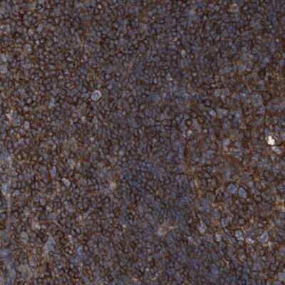 Immunohistochemistry-Paraffin: CCR6 Antibody [NBP1-88565]