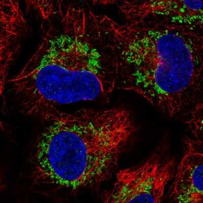 Immunocytochemistry/ Immunofluorescence: CCR7 Antibody [NBP2-57375]