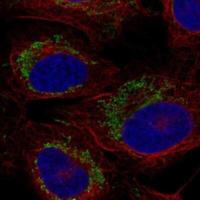 Immunocytochemistry/ Immunofluorescence: CCR7 Antibody [NBP2-58753]