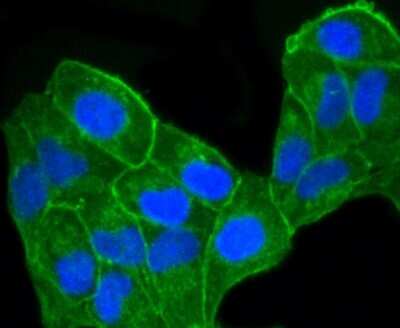 Immunocytochemistry/ Immunofluorescence: CCR7 Antibody (SR36-04) [NBP2-67324]