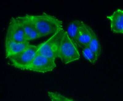 Immunocytochemistry/ Immunofluorescence: CCR7 Antibody (SR36-04) [NBP2-67324]