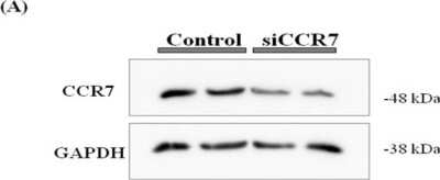 Knockdown Validated: CCR7 Antibody (SR36-04) [NBP2-67324]