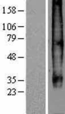 Western Blot: CCR7 Overexpression Lysate [NBP2-08171]