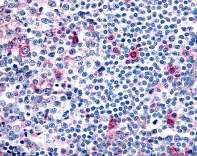 Immunohistochemistry-Paraffin: CCR8 Antibody - BSA Free [NLS3845]