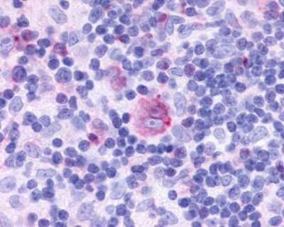 Immunohistochemistry-Paraffin: CCRL2/CRAM-A/B Antibody - BSA Free [NLS1093]