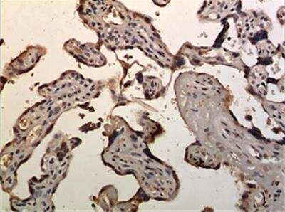 Immunohistochemistry-Paraffin: CCRL2/CRAM-A/B Antibody (MM0158-5A15) - Azide and BSA Free [NBP2-12137]