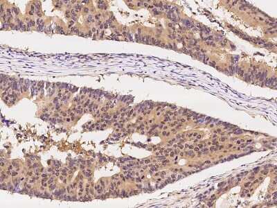 Immunohistochemistry-Paraffin: CCT3 Antibody [NBP2-99267]