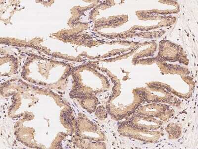 Immunohistochemistry-Paraffin: CCT3 Antibody [NBP2-99267]