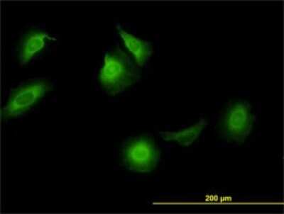 Immunocytochemistry/ Immunofluorescence: CCT5 Antibody (4E5-4B1) [H00022948-M01]