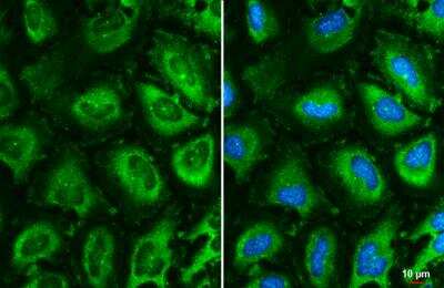 Immunocytochemistry/ Immunofluorescence: CCT5 Antibody (639) [NBP2-43680]