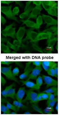 Immunocytochemistry/ Immunofluorescence: CCT5 Antibody [NBP1-31337]