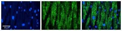 Immunohistochemistry: CCT5 Antibody [NBP1-56769]