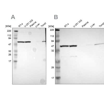 Western Blot: CCT5 Antibody [NBP1-83043]