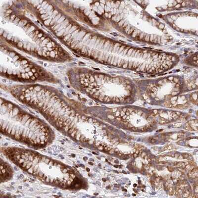Immunohistochemistry-Paraffin: CCT6A Antibody [NBP2-46686]