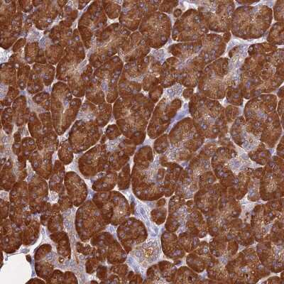 Immunohistochemistry-Paraffin: CCT6A Antibody [NBP2-46715]