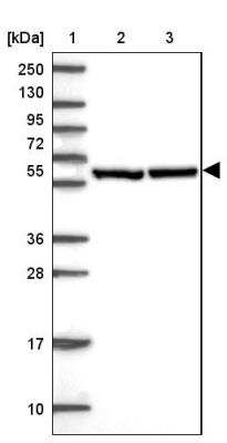 Western Blot: CCT6A Antibody [NBP2-46715]