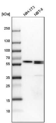 Western Blot: CCT6A Antibody [NBP2-46715]