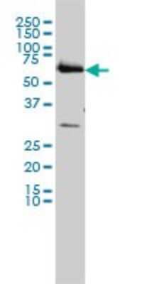 Western Blot: CCT6B Antibody (1A4) [H00010693-M01]