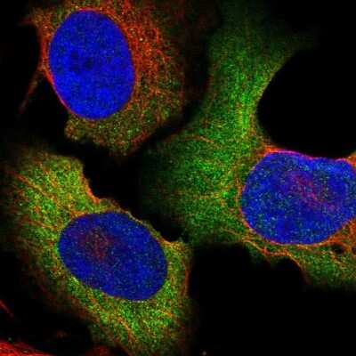 Immunocytochemistry/ Immunofluorescence: CCT6A Antibody [NBP2-33583]