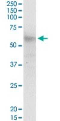 Western Blot: CCT6B Antibody [H00010693-B01P]