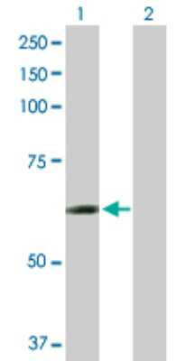 Western Blot: CCT6B Antibody [H00010693-D01P]