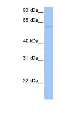 Western Blot: CCT6B Antibody [NBP1-56939]