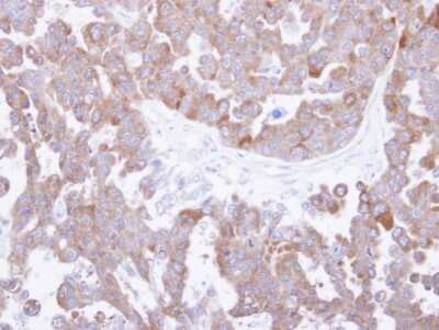 Immunohistochemistry-Paraffin: CCT8 Antibody [NBP1-33486]