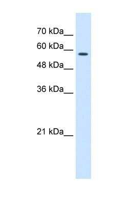 Western Blot: CCT8 Antibody [NBP1-56608]