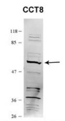 Western Blot: CCT8 Antibody [NBP1-56608]