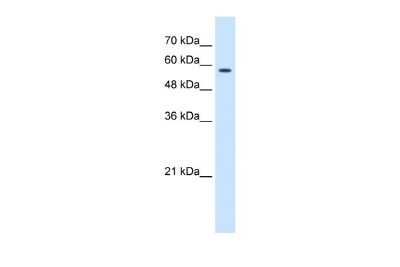 Western Blot: CCT8 Antibody [NBP1-56608]