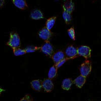 Immunocytochemistry/ Immunofluorescence: Endoglin/CD105 Antibody (3A9) - BSA Free [NBP2-22122]