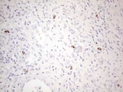Immunohistochemistry: CD117/c-kit Antibody (OTI2B12) [NBP2-45508]