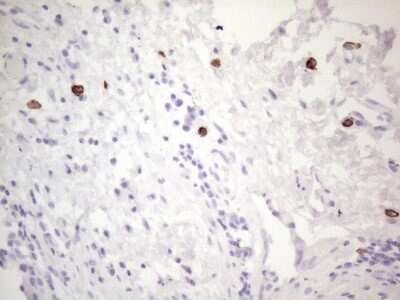 Immunohistochemistry: CD117/c-kit Antibody (OTI2B12) [NBP2-45508]