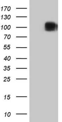 Western Blot: CD117/c-kit Antibody (OTI2B12) [NBP2-45508]