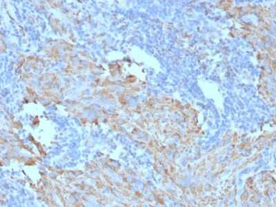 Immunohistochemistry-Paraffin: CD117/c-kit Antibody (C117/370) [NBP2-29423]