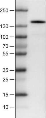 Western Blot: CD117/c-kit Antibody (CL1656) [NBP2-52974]