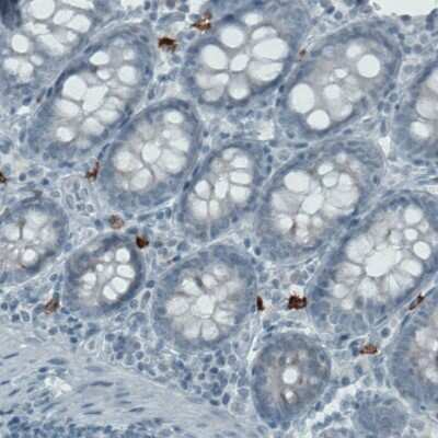 Immunohistochemistry-Paraffin: CD117/c-kit Antibody (CL1657) [NBP2-52975]
